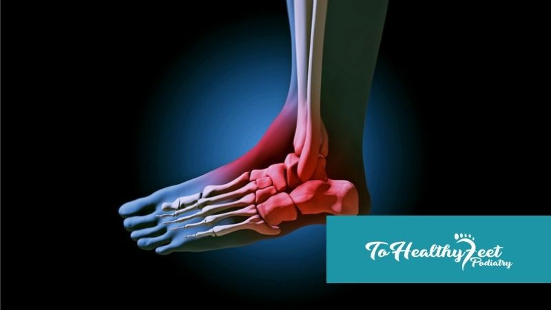 Understanding Tarsal Tunnel Syndrome: NYC Podiatrist’s Guide