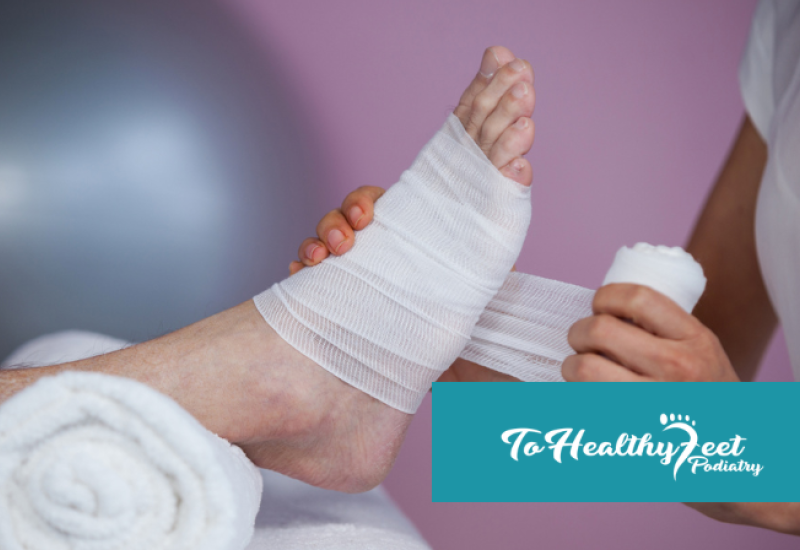 Minimally Invasive Bunion Surgery in NYC: Smaller Incisions, Faster Recovery