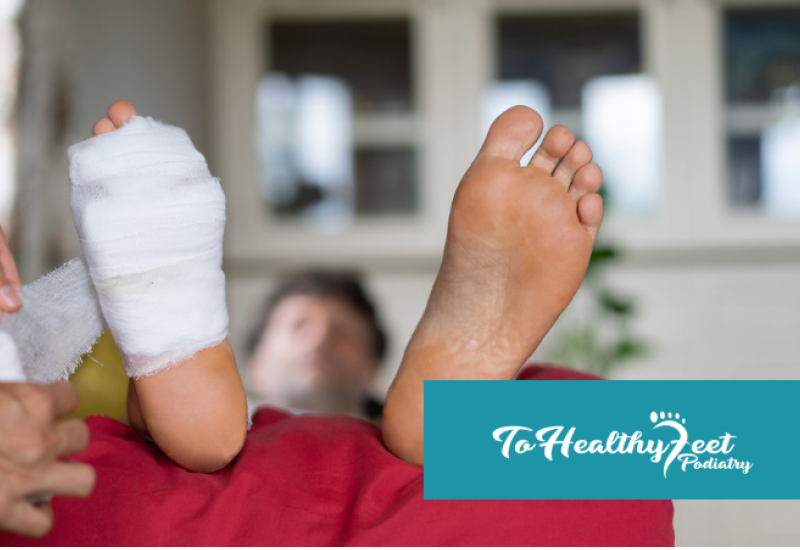 Bunion Surgery Recovery Timeline: What NYC Patients Should Expect