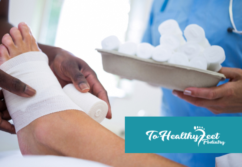 What to Expect After Morton’s Neuroma Surgery or Cryosurgery 