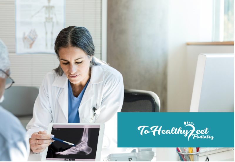 Upper East Side Foot Surgery: Advanced Minimally Invasive Care Close to Home