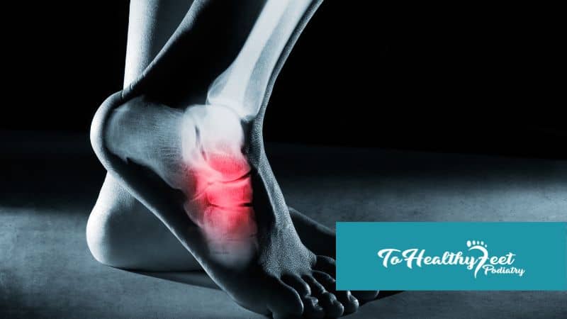 Recovery & Rehabilitation: What To Expect After a Foot Fracture