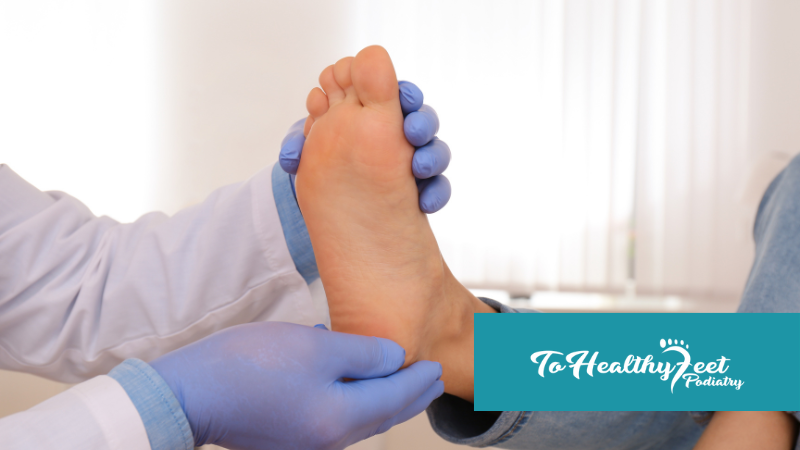 Burning, Tingling, or Numbness in Your Toes? What You Need to Know About Neuromas