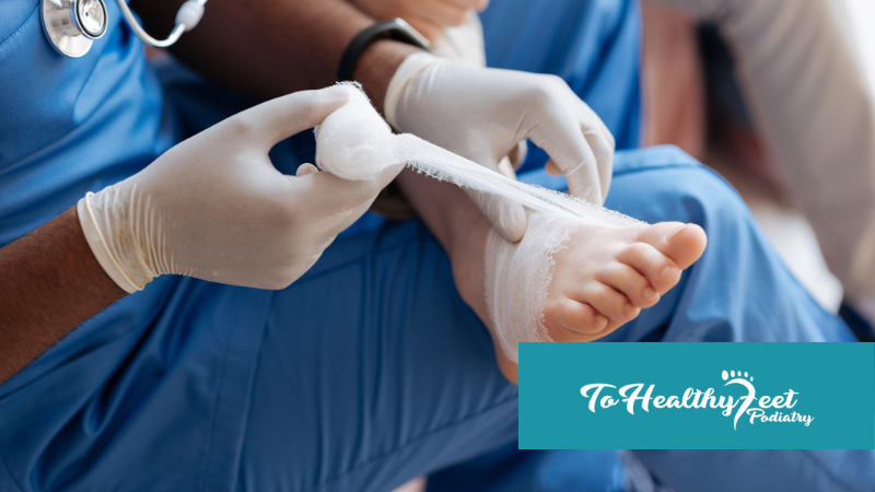 Morton’s Neuroma Surgery vs Cryosurgery: Which Option Is Right for You?