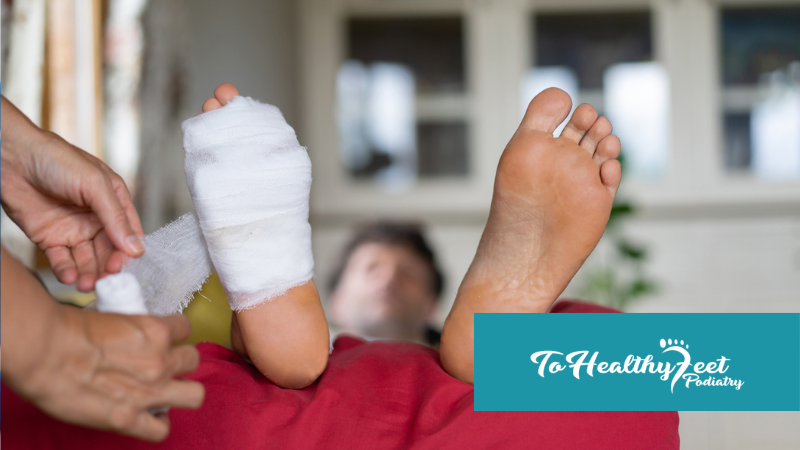 Bunion Surgery Recovery Timeline: What NYC Patients Should Expect