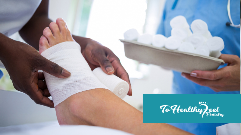 What to Expect After Morton’s Neuroma Surgery or Cryosurgery 